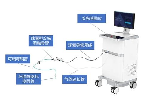 冷量可調 復溫提醒,上海又一自主研發冷凍消融創新產品獲批上市